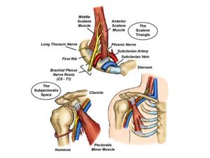 thoracic outlet syndrome test